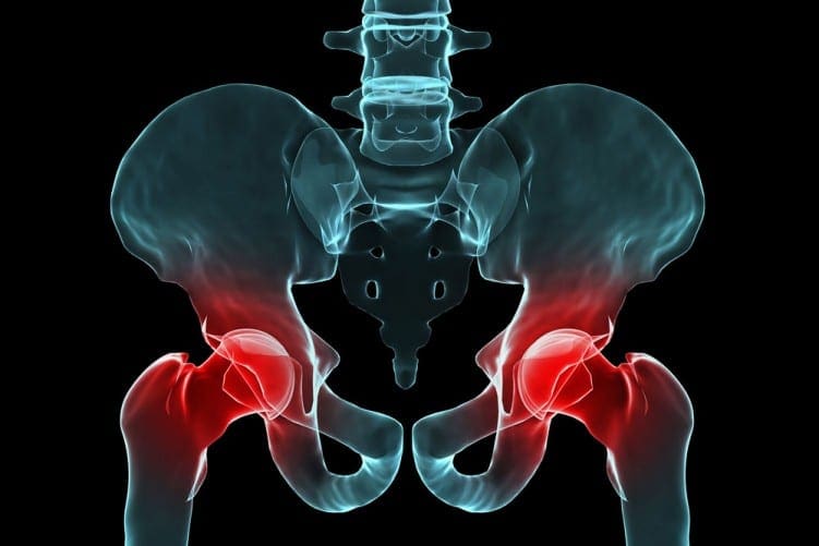 types of hip replacement