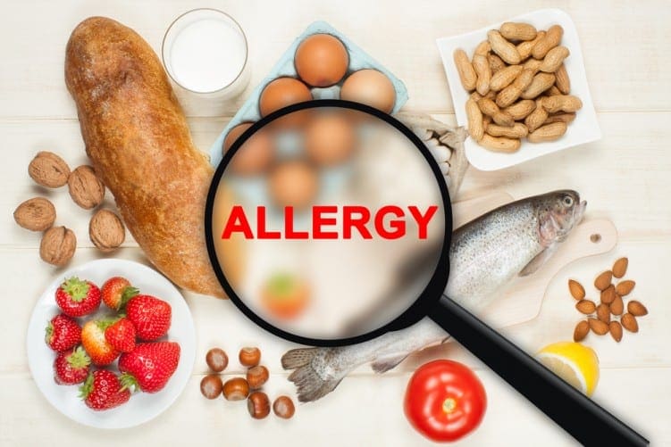 Food allergies