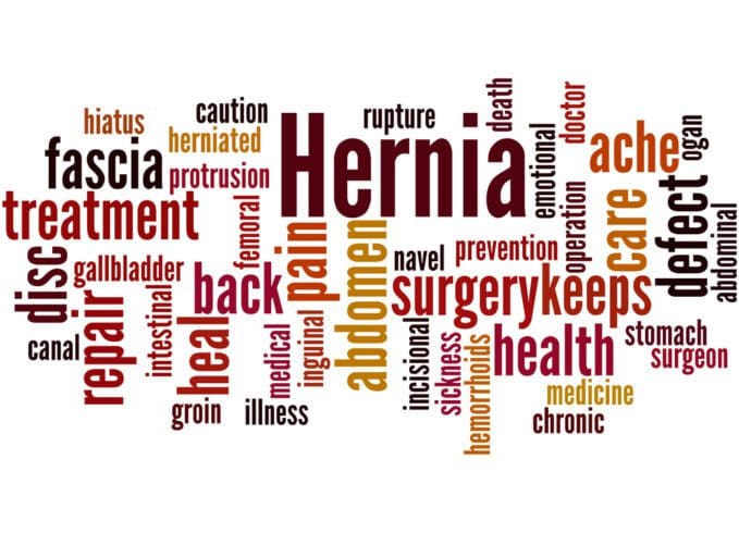 cost of hernia repair surgery