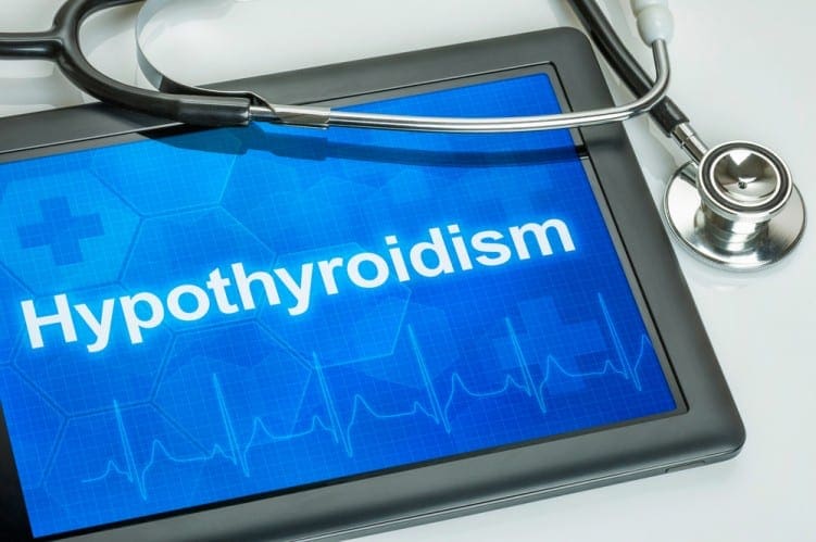 Hypothyroidism diagnosis