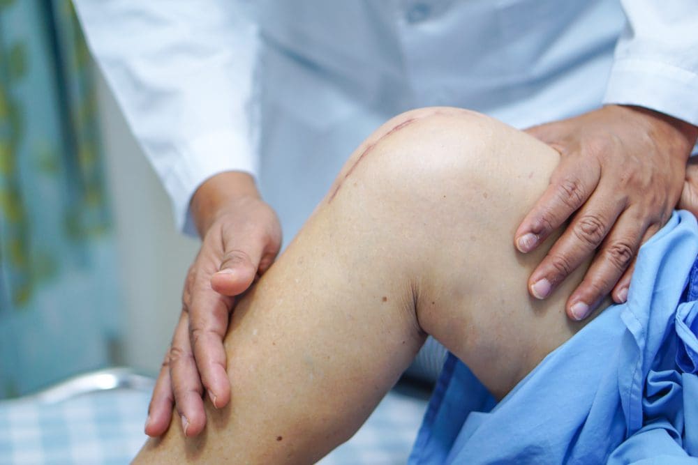 cost of knee replacement surgery