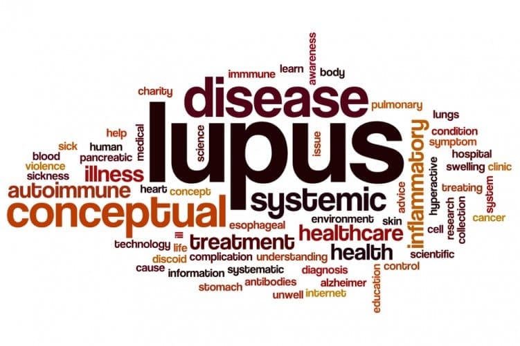 Lupus word cloud