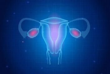 ‘Patchwork’ Ovarian Cancer Found To Be Most Deadly